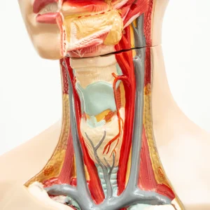 Duplex i Doppler karotida, TCD VB SLIVA